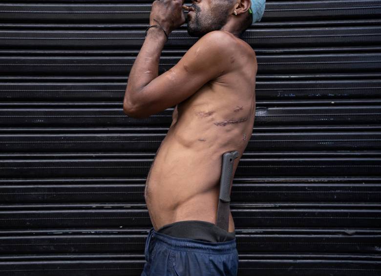 <b>Frankenstein </b>no es un monstruo de ciencia ficción, sino un hombre de la calle cosido a puñaladas y marcado por la vida en las calles del Bronx de Medellín. Ospina une las piezas rotas de la humanidad en esta imagen descarnada.